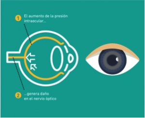 Presión intraocular en el ojo